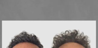 Diego Topa se hizo un retoque estético en la cara y causó impacto diego-topa-se-hizo-un-retoque-estetico-en-la-cara-y-causo-impacto